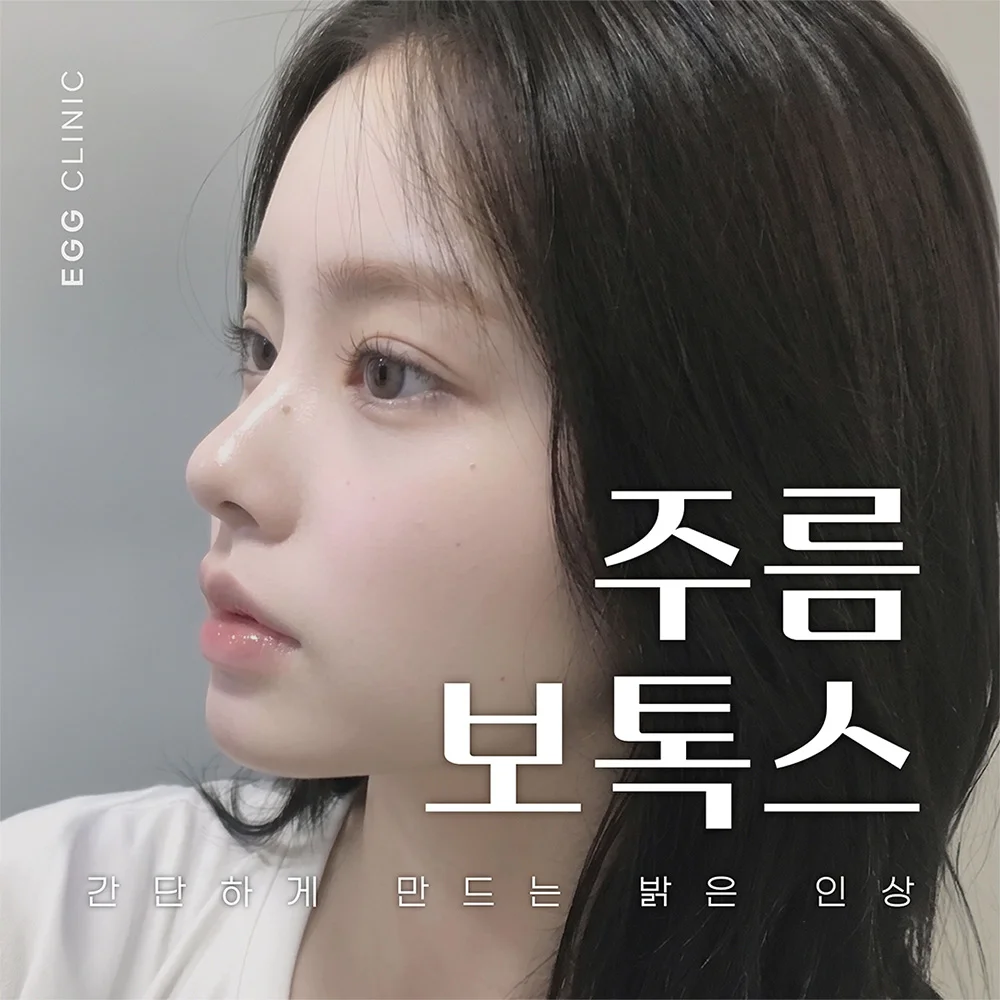 깊어지기 전 자연스럽게, 주름 보톡스