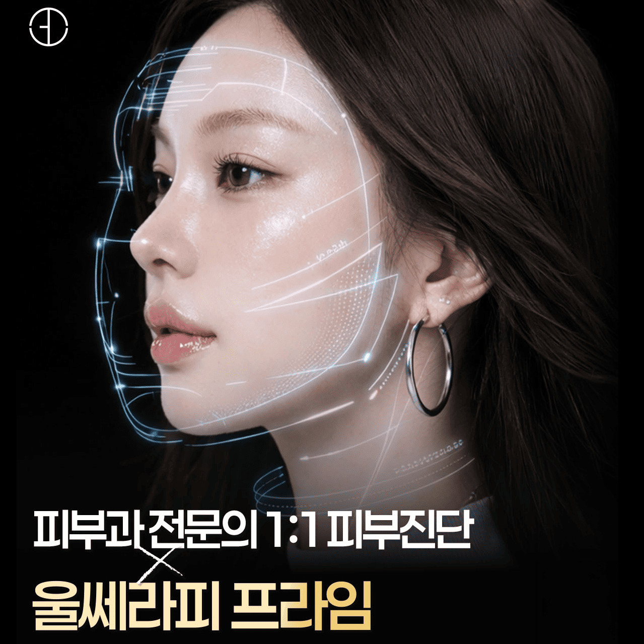 피부과전문의 맞춤 디자인, 울쎄라피 프라임
